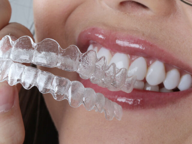 Alinhadores Dentais – O Aparelho Invisível Que Transforma Sorrisos Sem Aparato Metálico! Besmile interlagos.