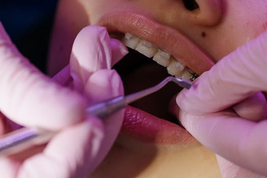 Cáries e aparelho: entenda os riscos, cuidados e como evitar manchas nos dentes